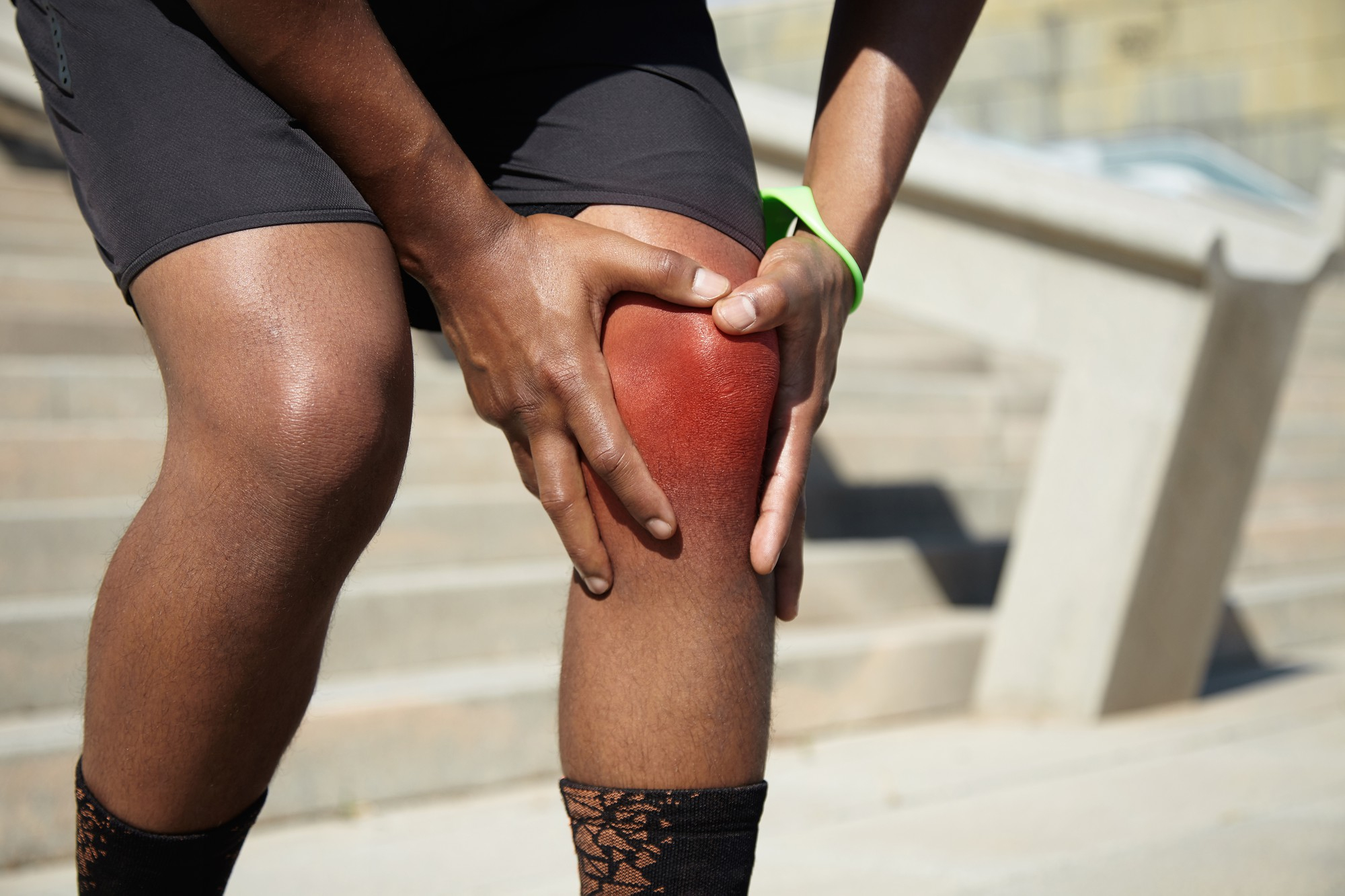Patellar luxation: symptoms and treatment - Fasciaclinics.com